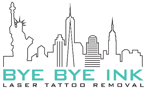 Bye Bye Ink Laser Tattoo Removal